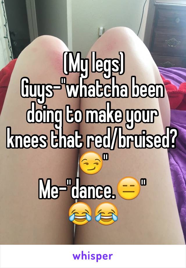  (My legs)
Guys-"whatcha been doing to make your knees that red/bruised?😏"
Me-"dance.😑"
😂😂