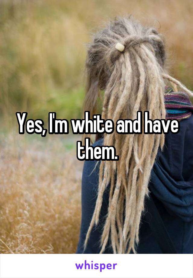 Yes, I'm white and have them.