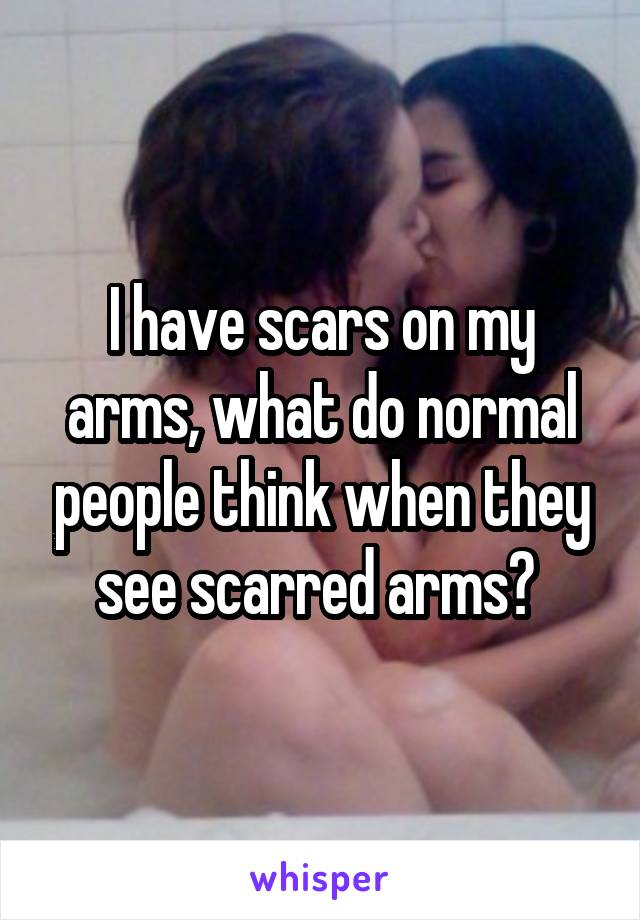 I have scars on my arms, what do normal people think when they see scarred arms? 