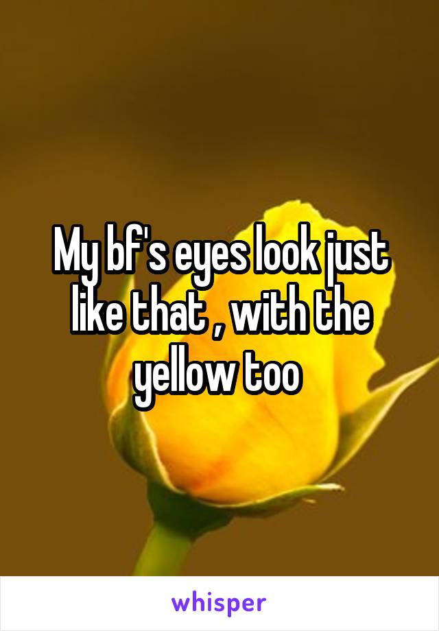 My bf's eyes look just like that , with the yellow too 