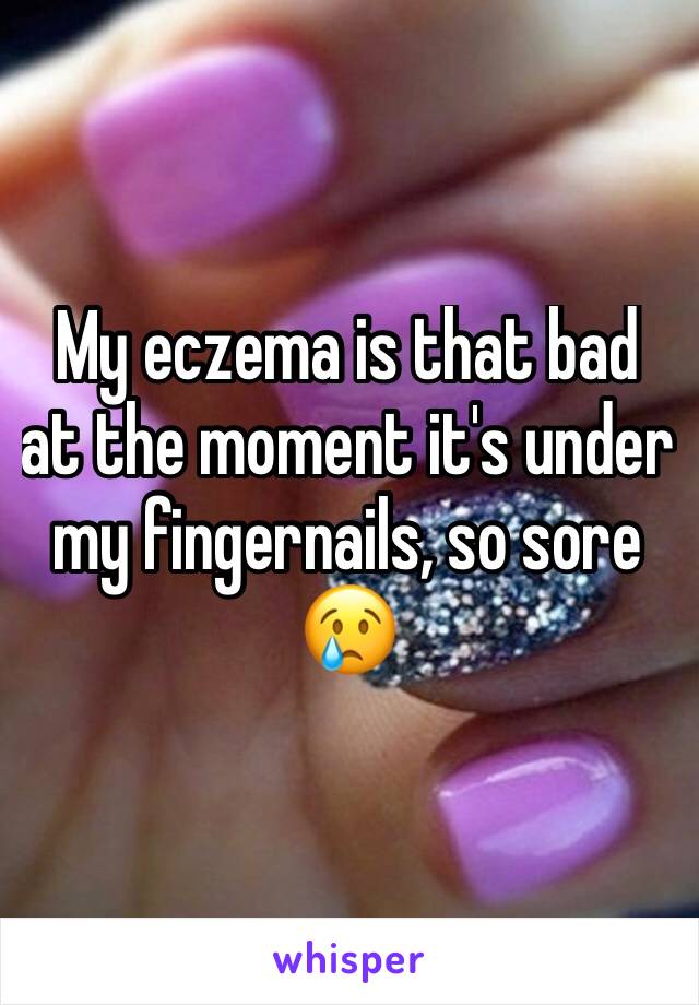 My eczema is that bad at the moment it's under my fingernails, so sore 😢