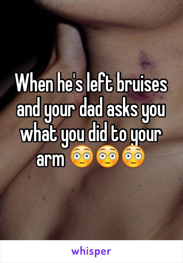 When he's left bruises and your dad asks you what you did to your arm 😳😳😳
