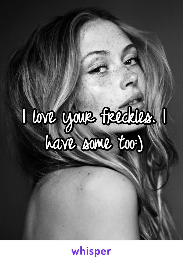 I love your freckles. I have some too:)