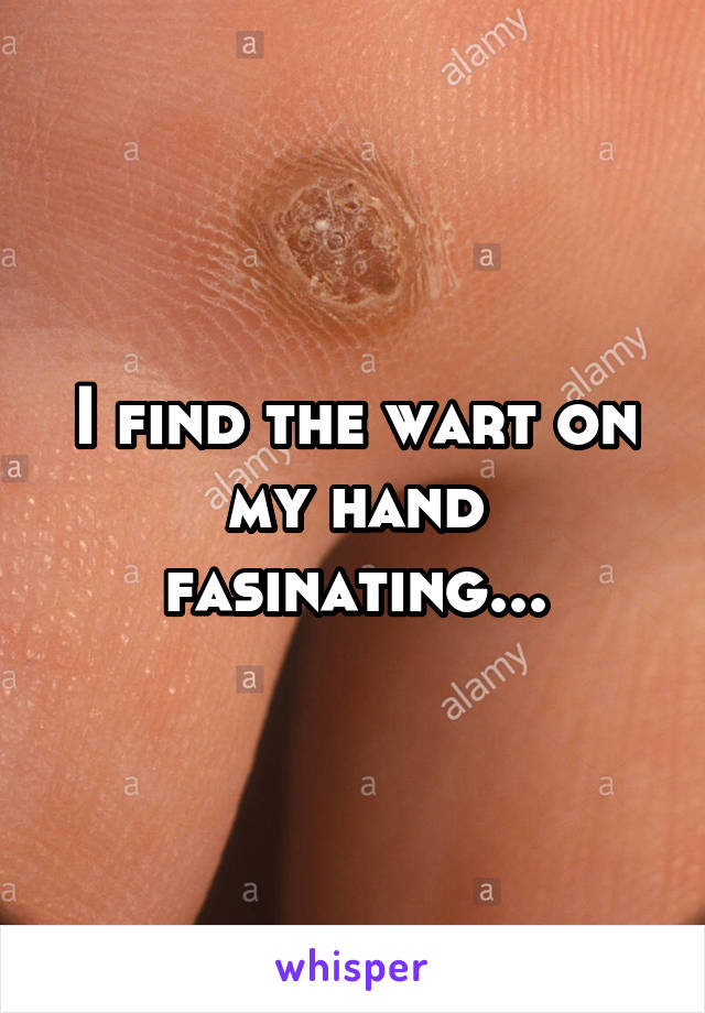 I find the wart on my hand fasinating...