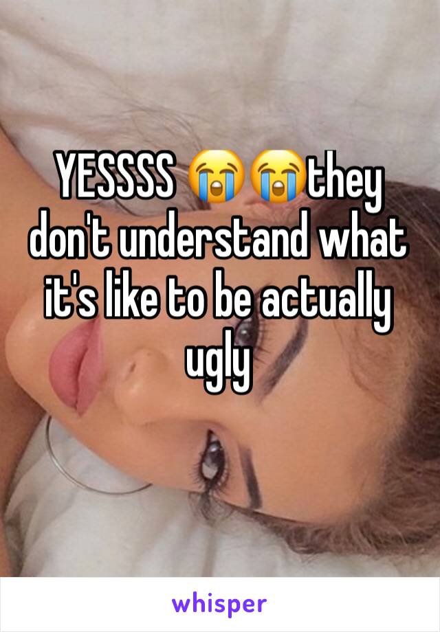 YESSSS 😭😭they don't understand what it's like to be actually ugly 