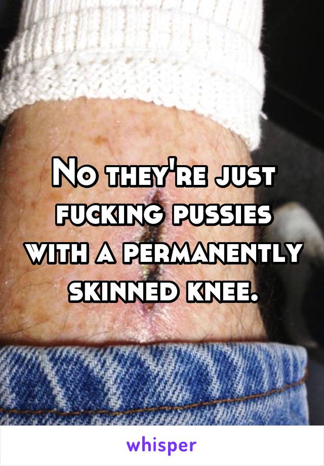 No they're just fucking pussies with a permanently skinned knee.