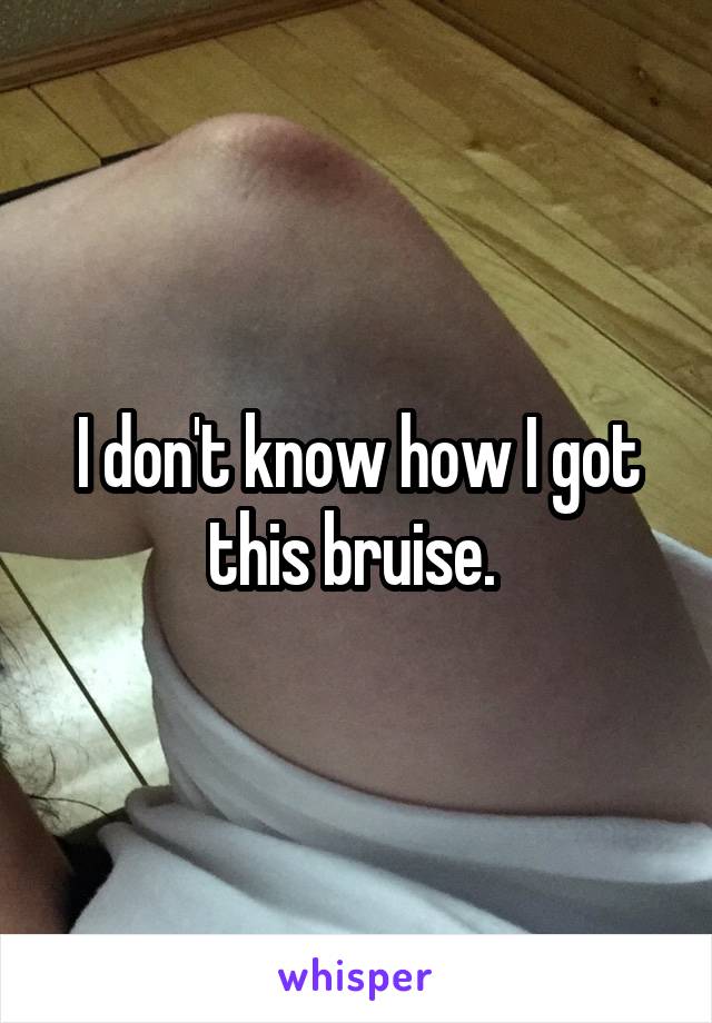 I don't know how I got this bruise. 