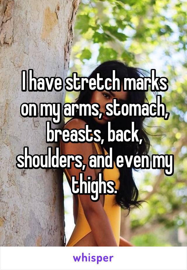 I have stretch marks on my arms, stomach, breasts, back, shoulders, and even my thighs.