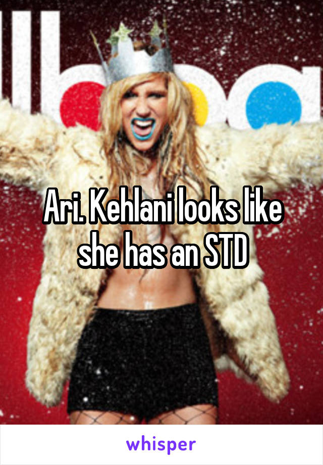 Ari. Kehlani looks like she has an STD