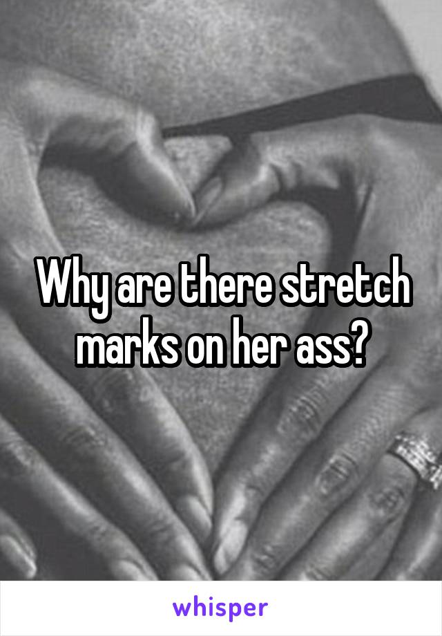 Why are there stretch marks on her ass?