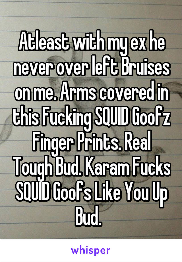 Atleast with my ex he never over left Bruises on me. Arms covered in this Fucking SQUID Goofz Finger Prints. Real Tough Bud. Karam Fucks SQUID Goofs Like You Up Bud.  