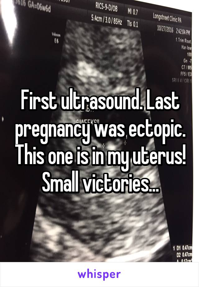First ultrasound. Last pregnancy was ectopic. This one is in my uterus! Small victories...