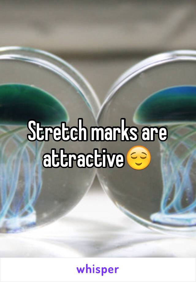 Stretch marks are attractive😌