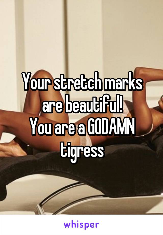 Your stretch marks are beautiful!
You are a GODAMN tigress