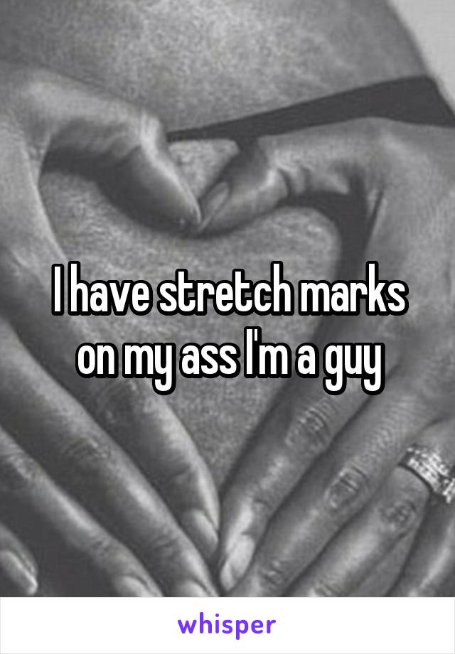 I have stretch marks on my ass I'm a guy