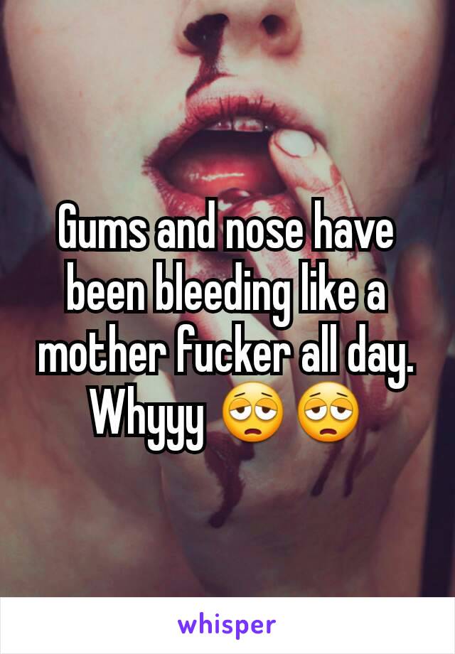 Gums and nose have been bleeding like a mother fucker all day. Whyyy 😩😩