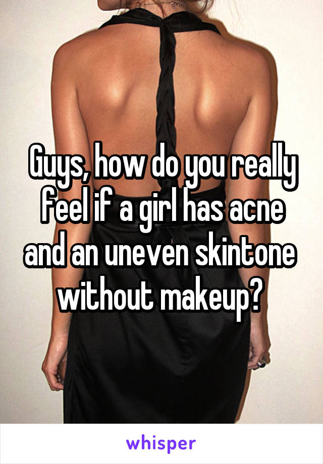 Guys, how do you really feel if a girl has acne and an uneven skintone  without makeup? 