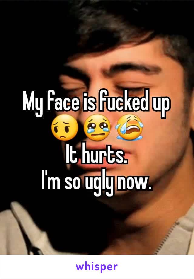 My face is fucked up
😔😢😭
It hurts.
I'm so ugly now.