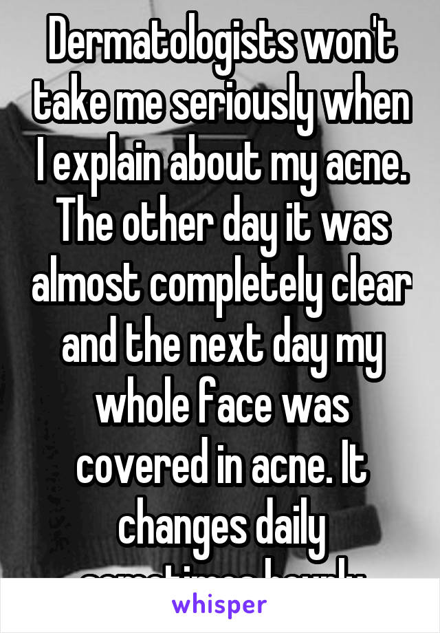 Dermatologists won't take me seriously when I explain about my acne. The other day it was almost completely clear and the next day my whole face was covered in acne. It changes daily sometimes hourly