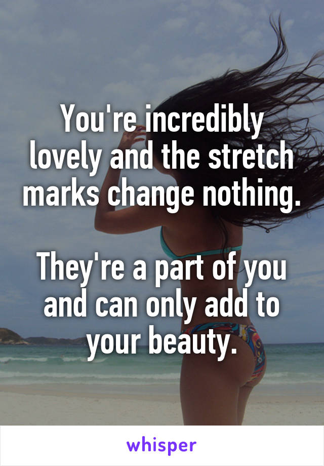 You're incredibly lovely and the stretch marks change nothing.

They're a part of you and can only add to your beauty.