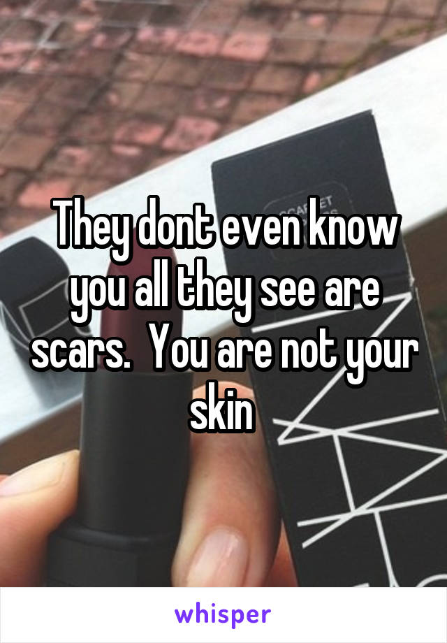 They dont even know you all they see are scars.  You are not your skin 
