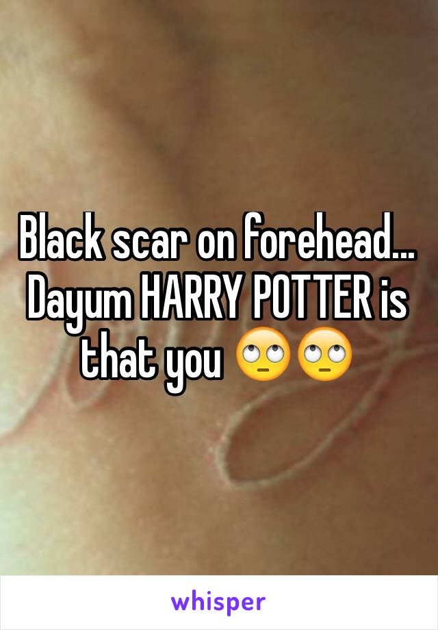 Black scar on forehead... Dayum HARRY POTTER is that you 🙄🙄