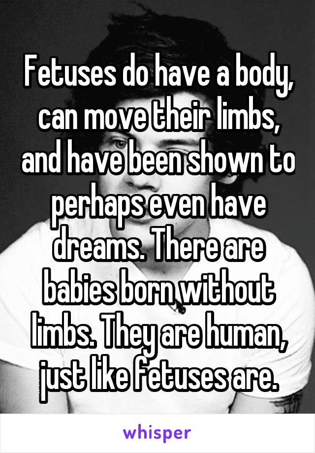 Fetuses do have a body, can move their limbs, and have been shown to perhaps even have dreams. There are babies born without limbs. They are human, just like fetuses are.