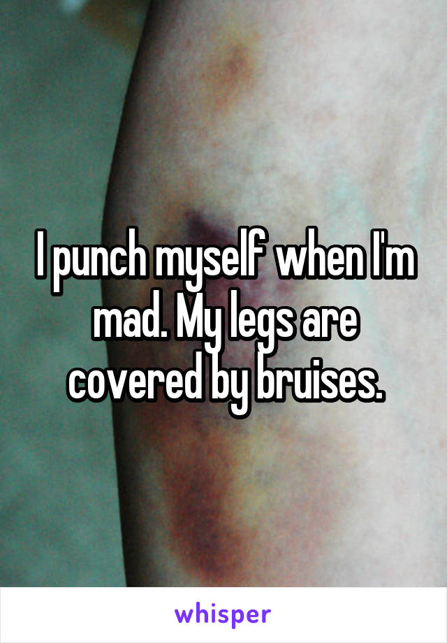 I punch myself when I'm mad. My legs are covered by bruises.