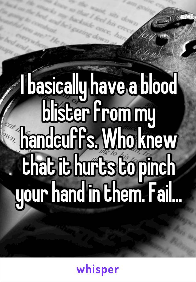 I basically have a blood blister from my handcuffs. Who knew that it hurts to pinch your hand in them. Fail...