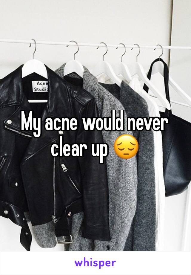 My acne would never clear up 😔