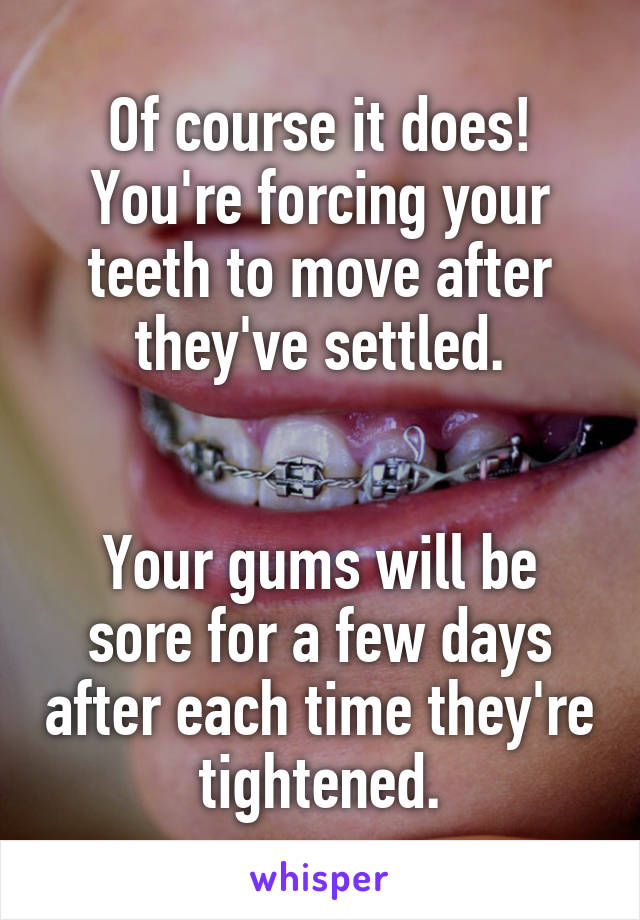 Of course it does! You're forcing your teeth to move after they've settled.


Your gums will be sore for a few days after each time they're tightened.