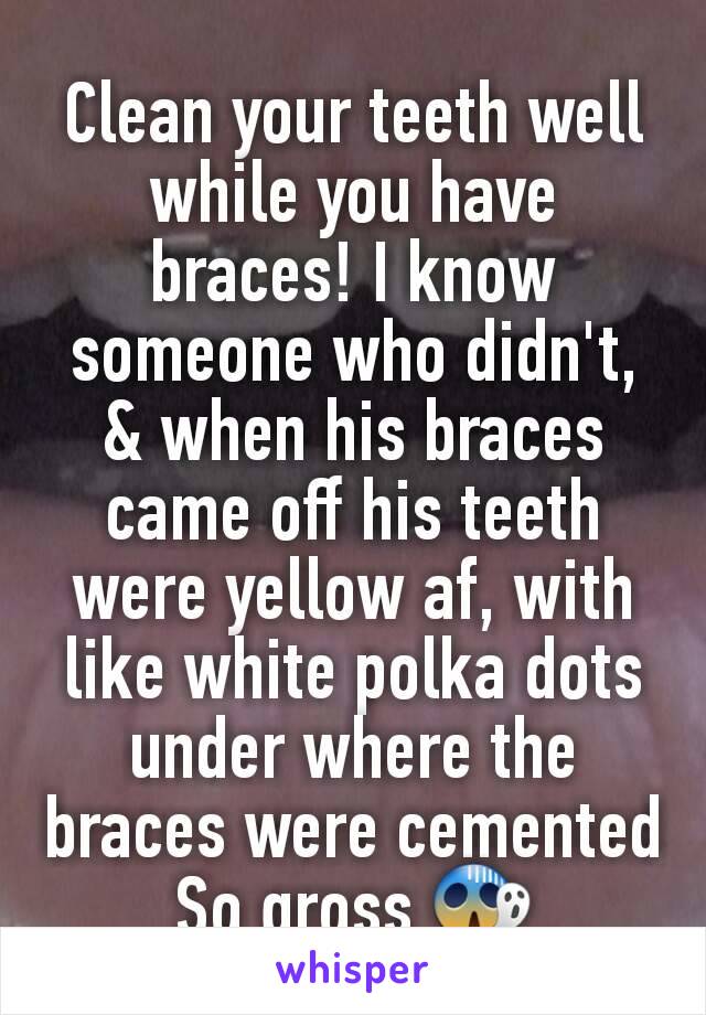 Clean your teeth well while you have braces! I know someone who didn't, & when his braces came off his teeth were yellow af, with like white polka dots under where the braces were cemented
So gross 😱