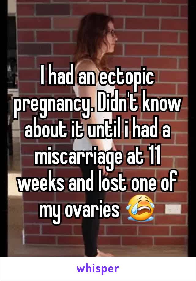 I had an ectopic pregnancy. Didn't know about it until i had a miscarriage at 11 weeks and lost one of my ovaries 😭