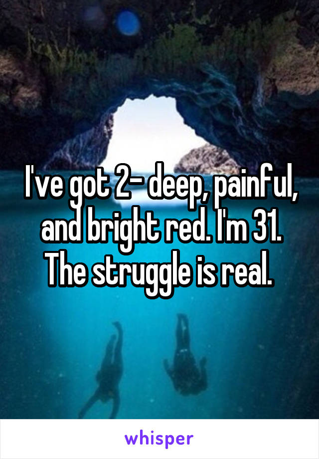 I've got 2- deep, painful, and bright red. I'm 31. The struggle is real. 