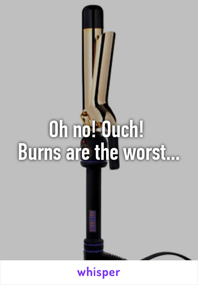 Oh no! Ouch! 
Burns are the worst...