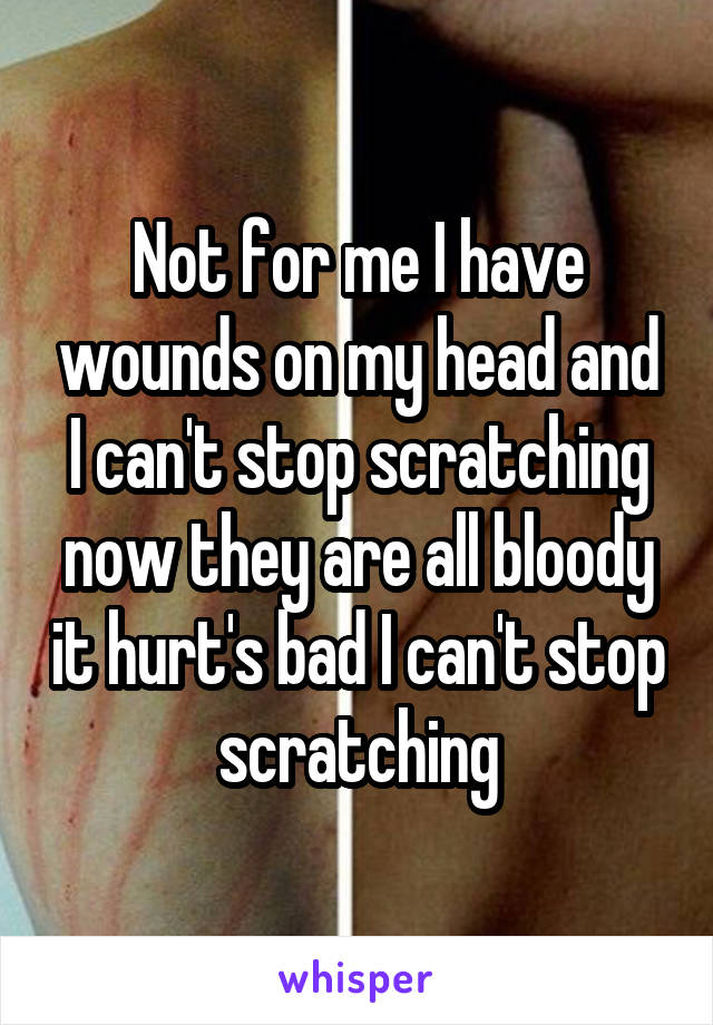 Not for me I have wounds on my head and I can't stop scratching now they are all bloody it hurt's bad I can't stop scratching