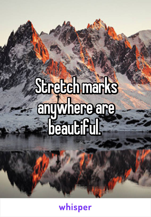 Stretch marks anywhere are beautiful. 
