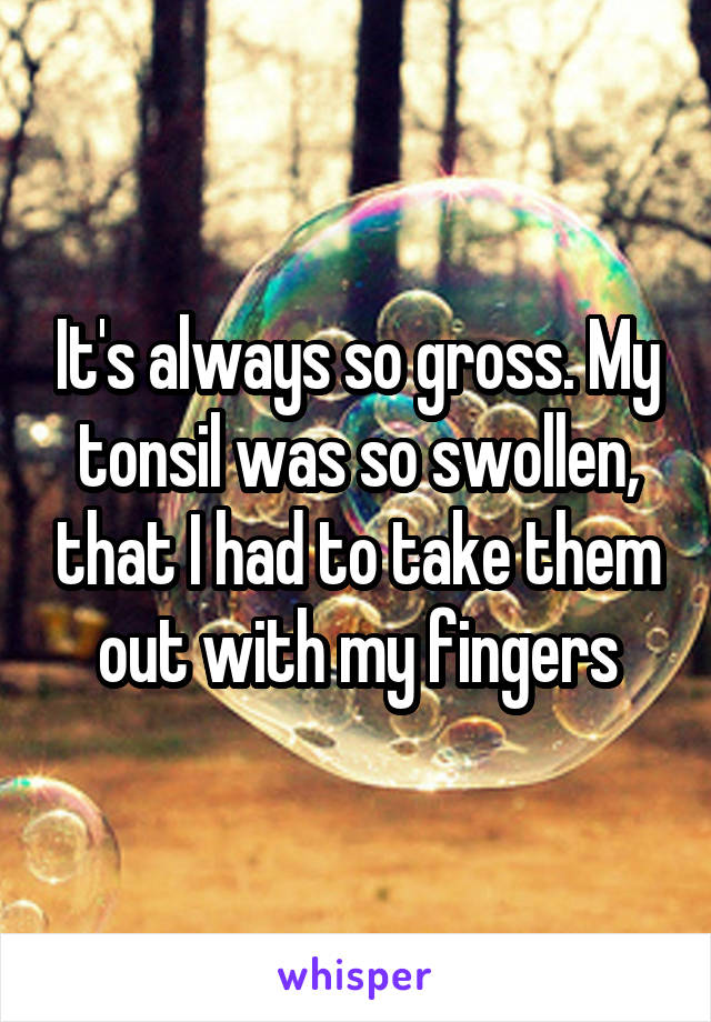 It's always so gross. My tonsil was so swollen, that I had to take them out with my fingers