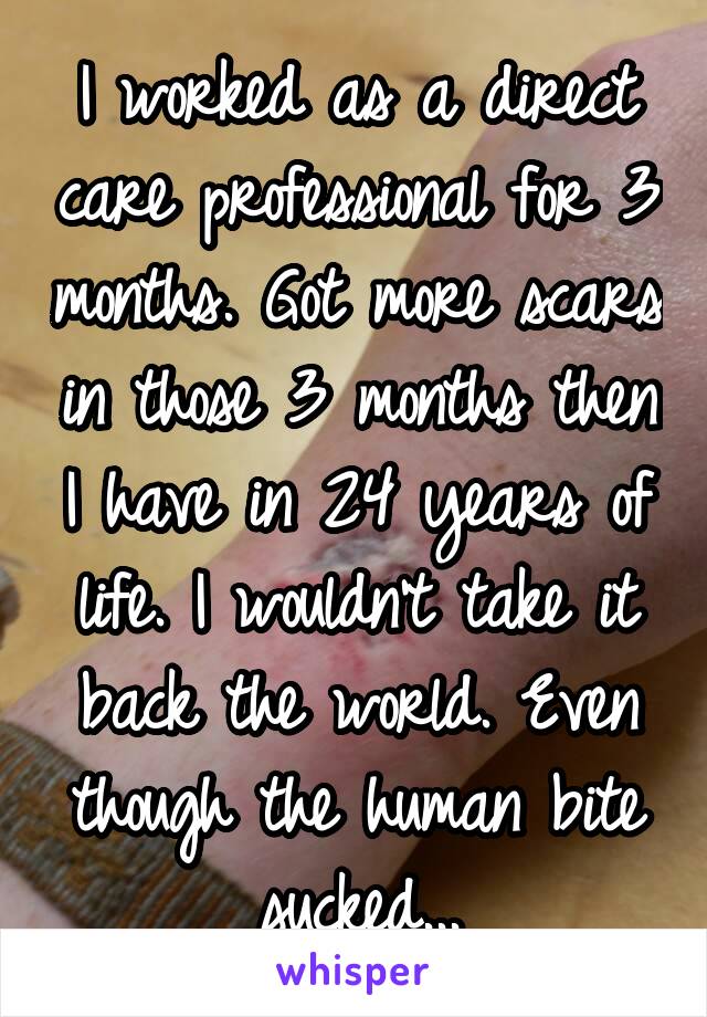 I worked as a direct care professional for 3 months. Got more scars in those 3 months then I have in 24 years of life. I wouldn't take it back the world. Even though the human bite sucked...