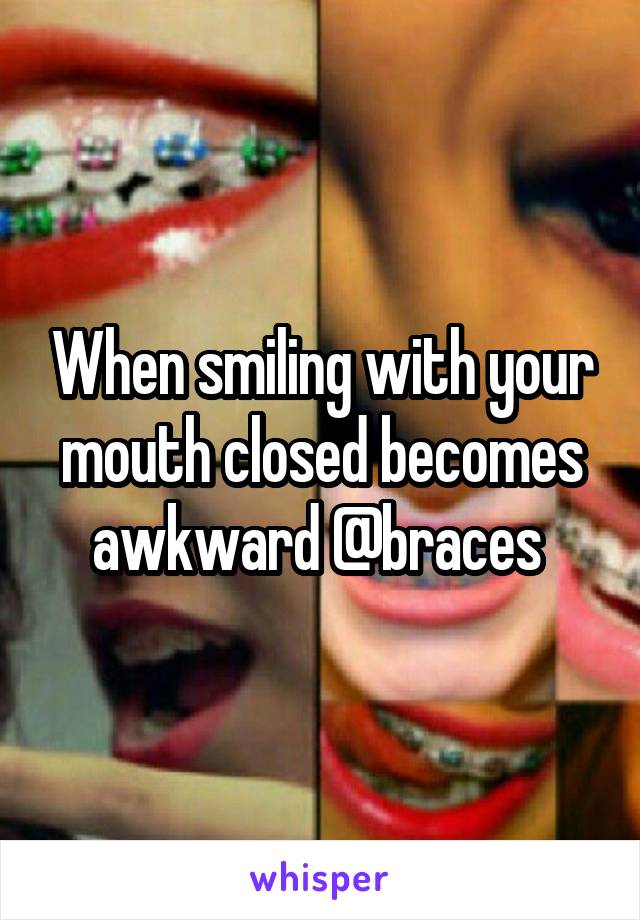 When smiling with your mouth closed becomes awkward @braces 