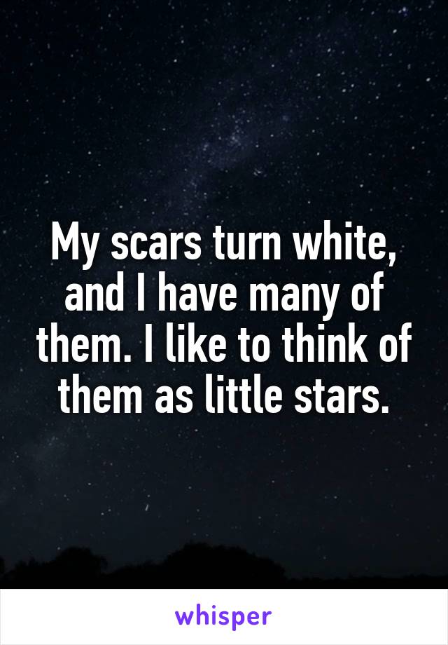 My scars turn white, and I have many of them. I like to think of them as little stars.