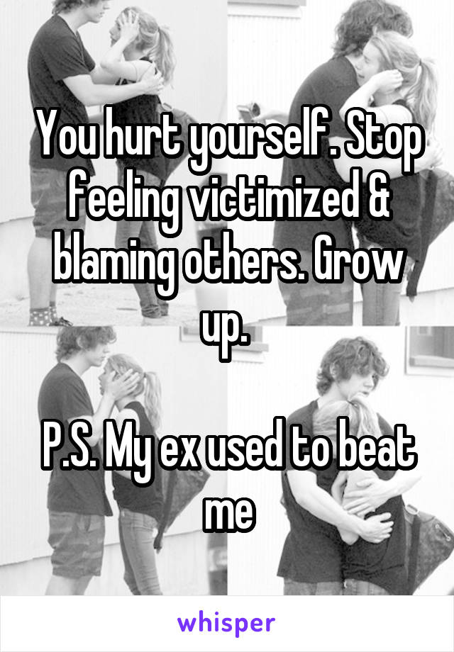 You hurt yourself. Stop feeling victimized & blaming others. Grow up. 

P.S. My ex used to beat me