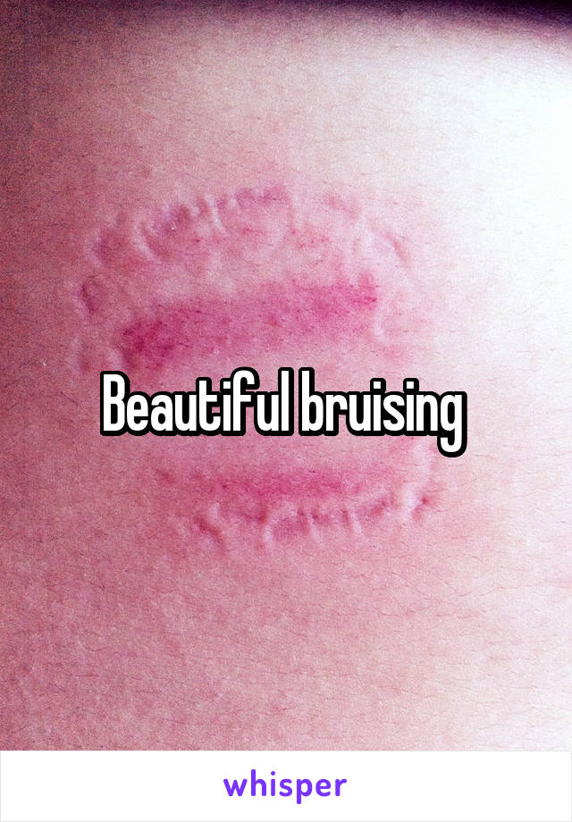 Beautiful bruising 