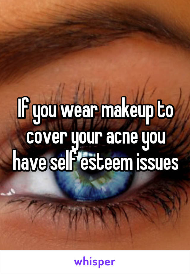 If you wear makeup to cover your acne you have self esteem issues