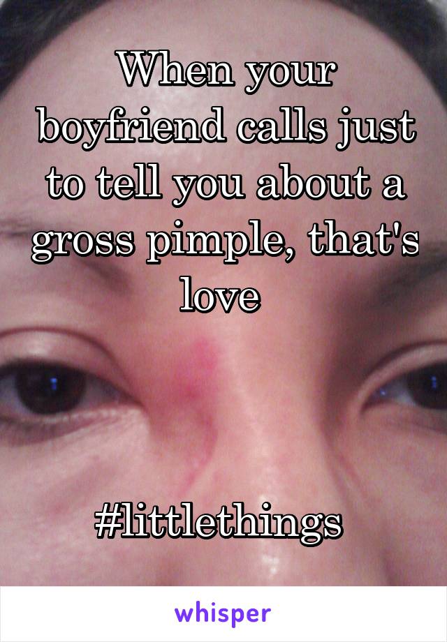 When your boyfriend calls just to tell you about a gross pimple, that's love 



#littlethings 
