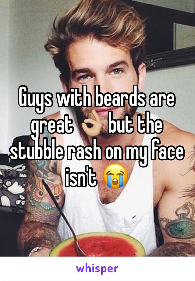 Guys with beards are great 👌🏼 but the stubble rash on my face isn't 😭