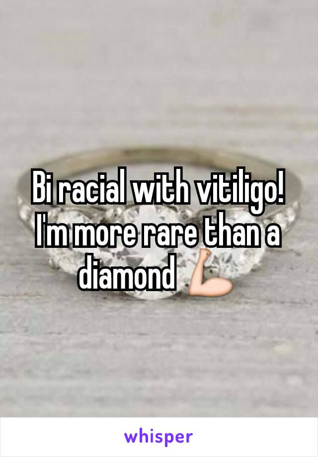 Bi racial with vitiligo!
I'm more rare than a diamond 💪