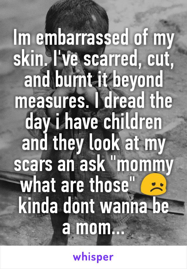 Im embarrassed of my skin. I've scarred, cut, and burnt it beyond measures. I dread the day i have children and they look at my scars an ask "mommy what are those" 😞 kinda dont wanna be a mom...