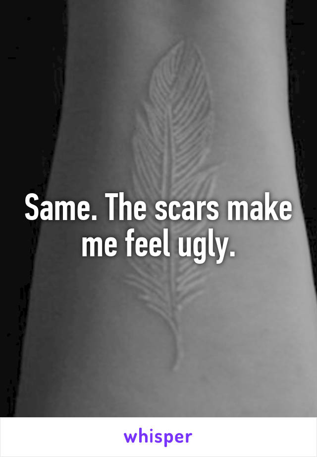 Same. The scars make me feel ugly.