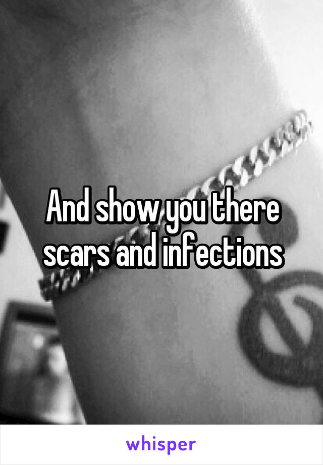 And show you there scars and infections